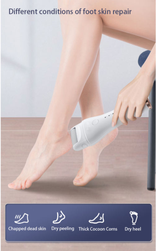 ENCHEN Rock Electric Foot Callus Remover